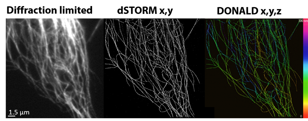 microtubule_donald